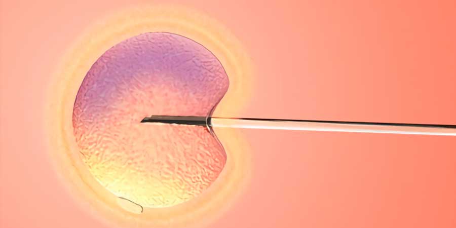 Inseminació artificial