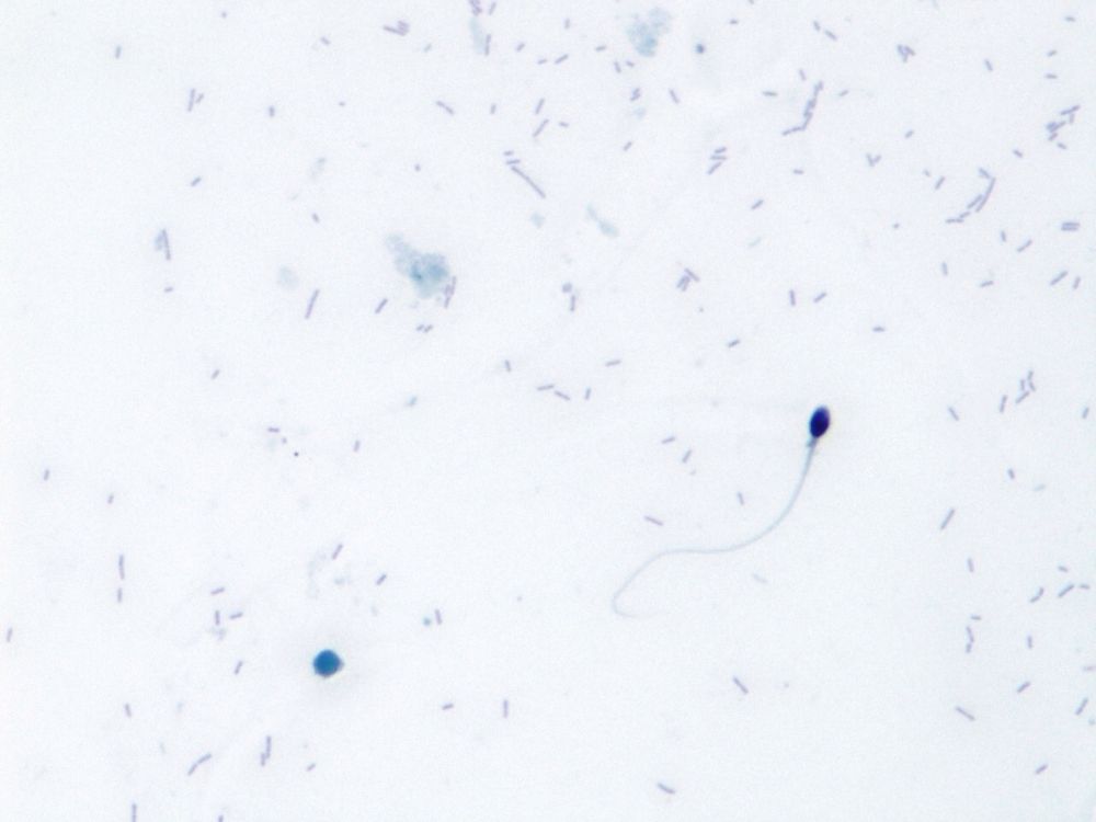 Biopsia testicular​-Conceptum