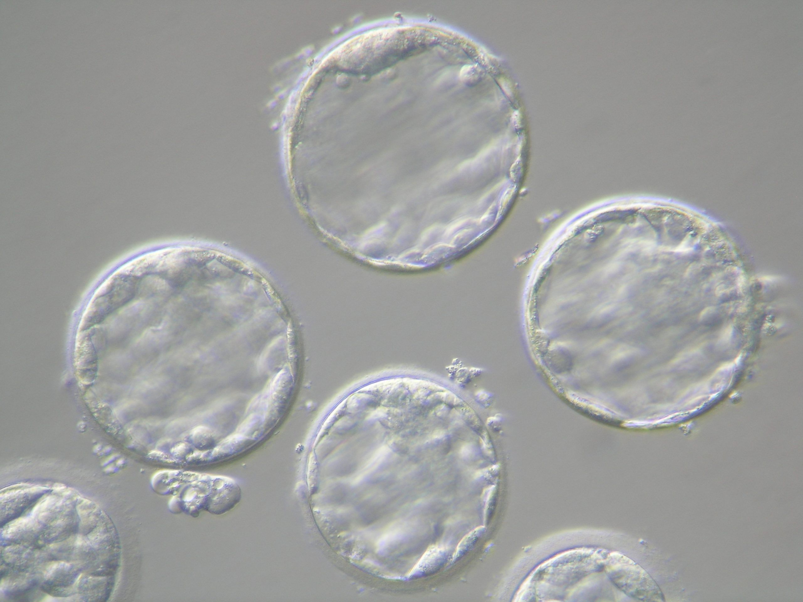 Embiornes y fecundación in vitro