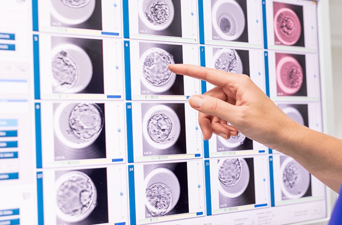 Эмбриоскоп. Эмбриоскоп фото. Эмбриоскоп цена аппарата. Если мы используем эмбриоскоп нам обязаны показывать наших эмбрионов.